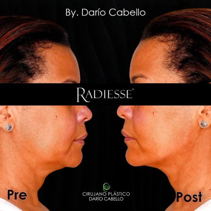 Case 1 Before and After