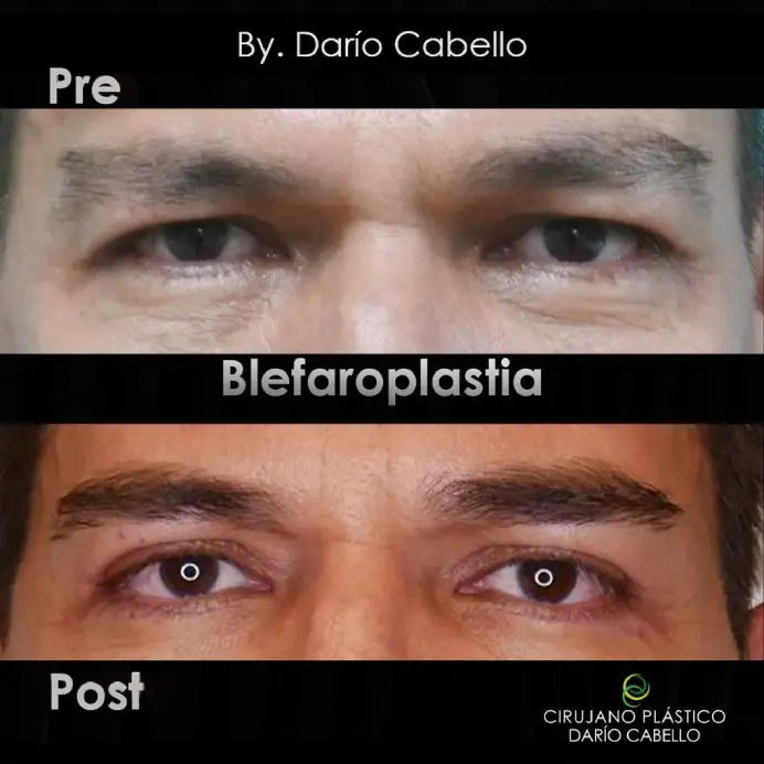 Case 0 Before and After