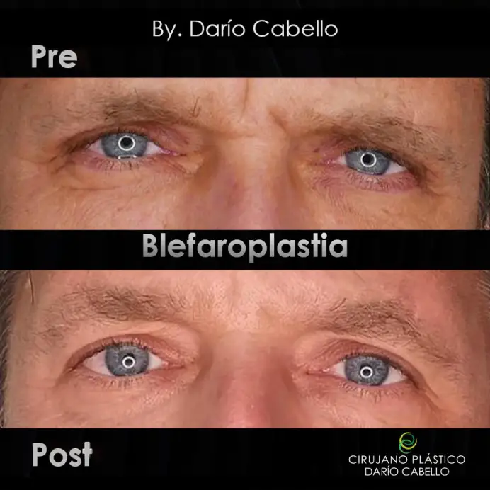Case 1 Before and After