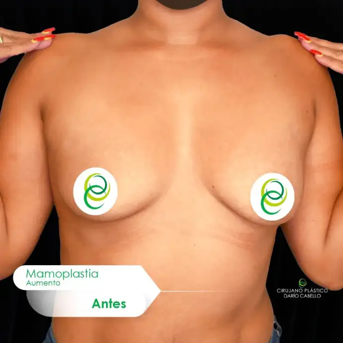 Case 0 Before and After