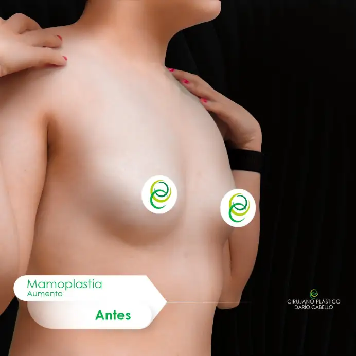 Case 4 Before and After