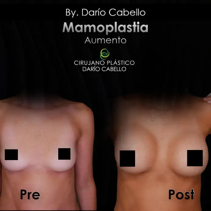 Case 6 Before and After