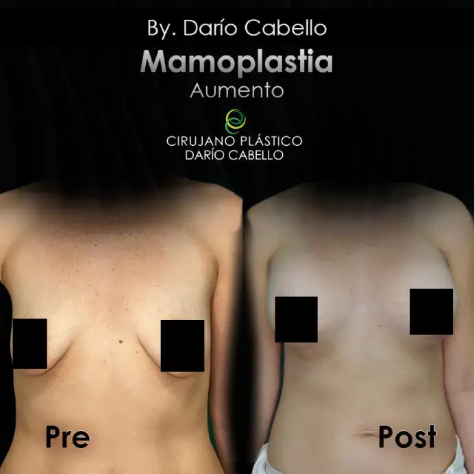 Case 7 Before and After