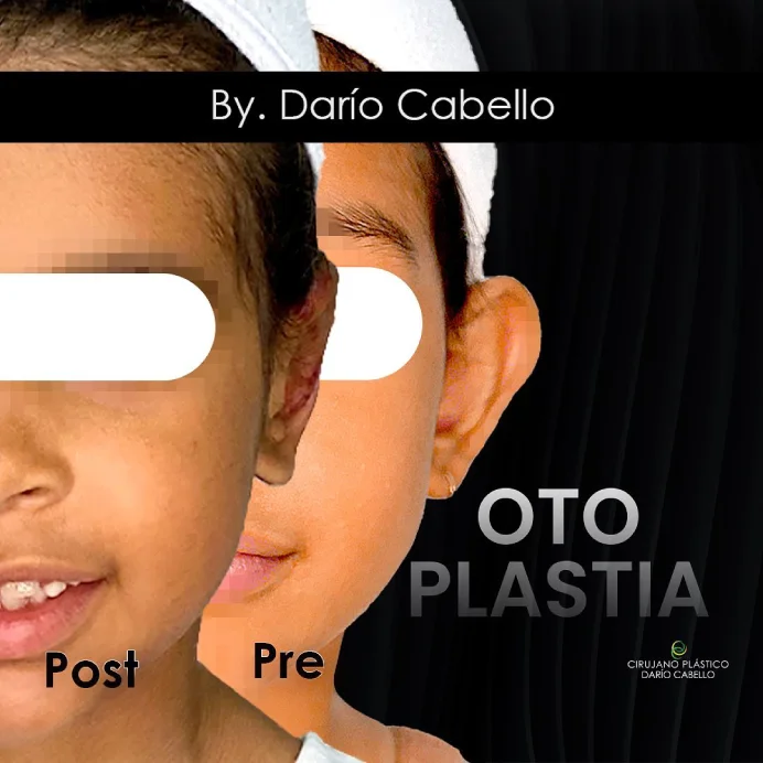 Case 2 Before and After