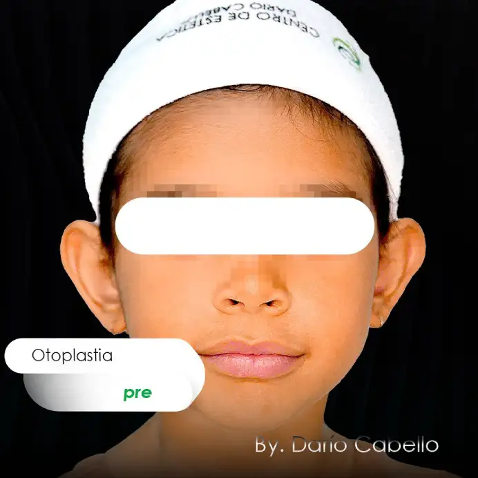 Case 1 Before and After