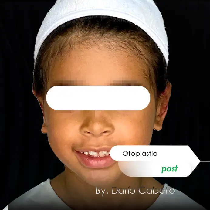 Case 2 Before and After