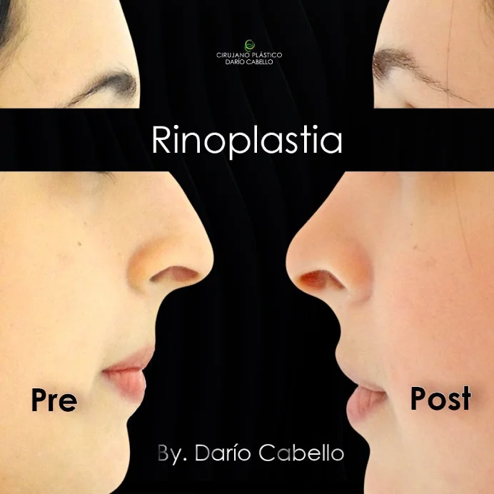 Case 3 Before and After