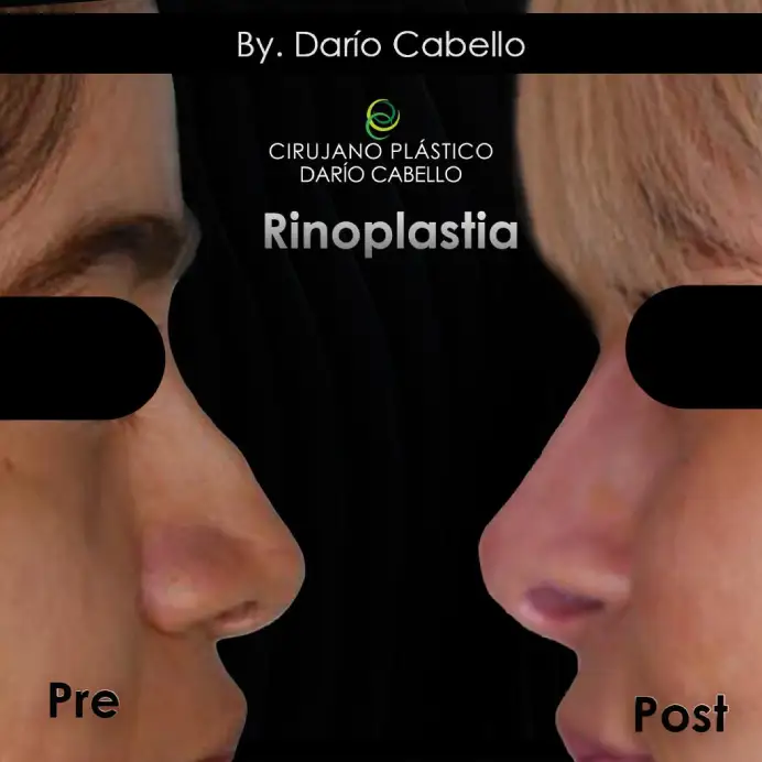 Case 1 Before and After