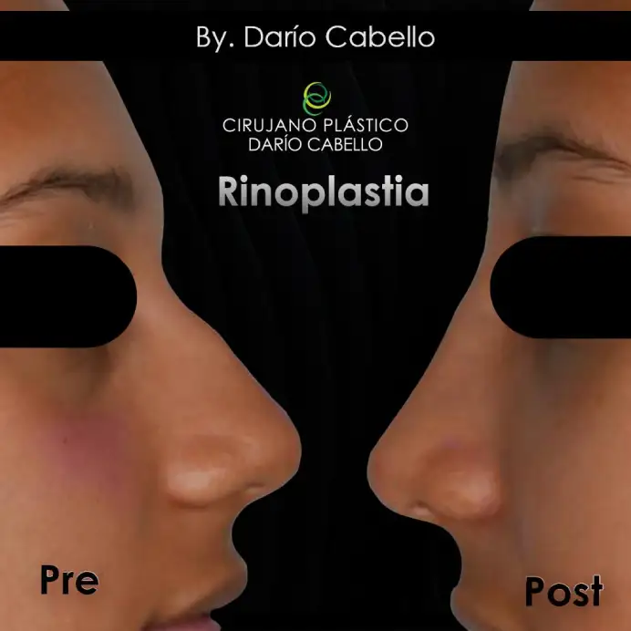 Case 2 Before and After