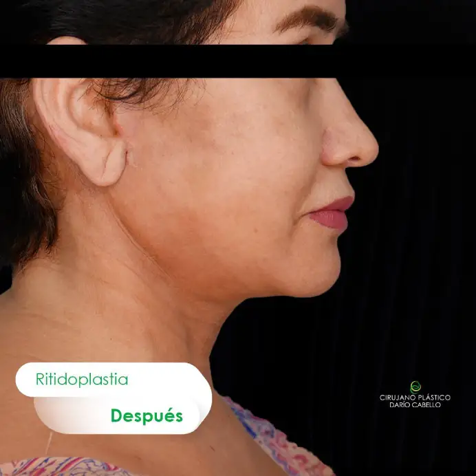 Case 10 Before and After