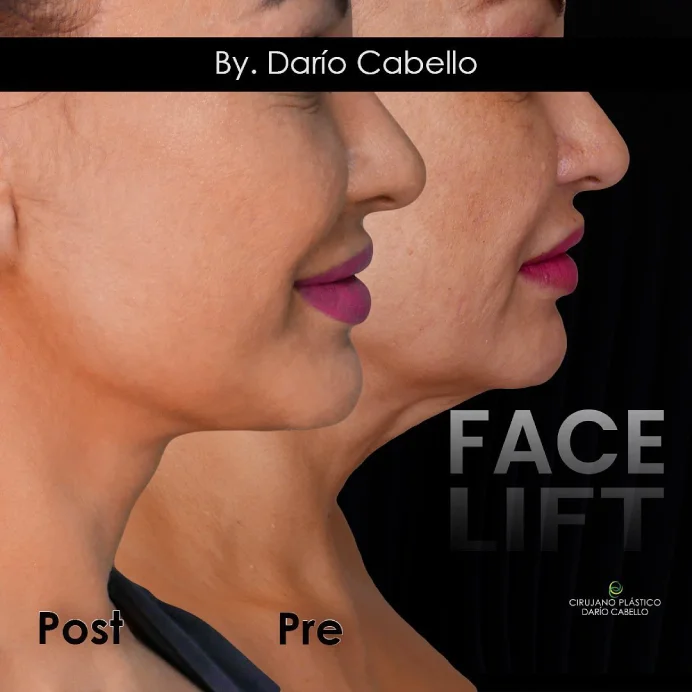 Case 5 Before and After