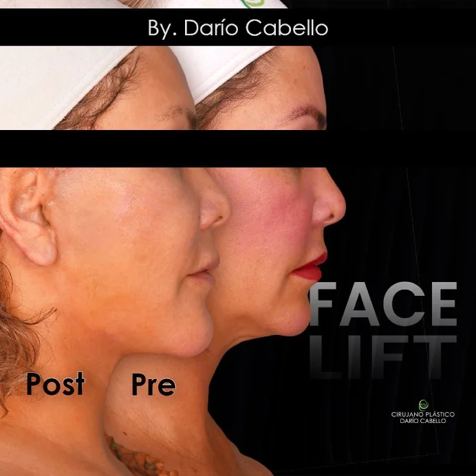 Case 6 Before and After