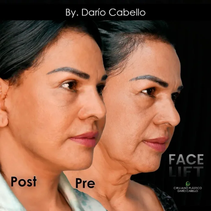 Case 7 Before and After