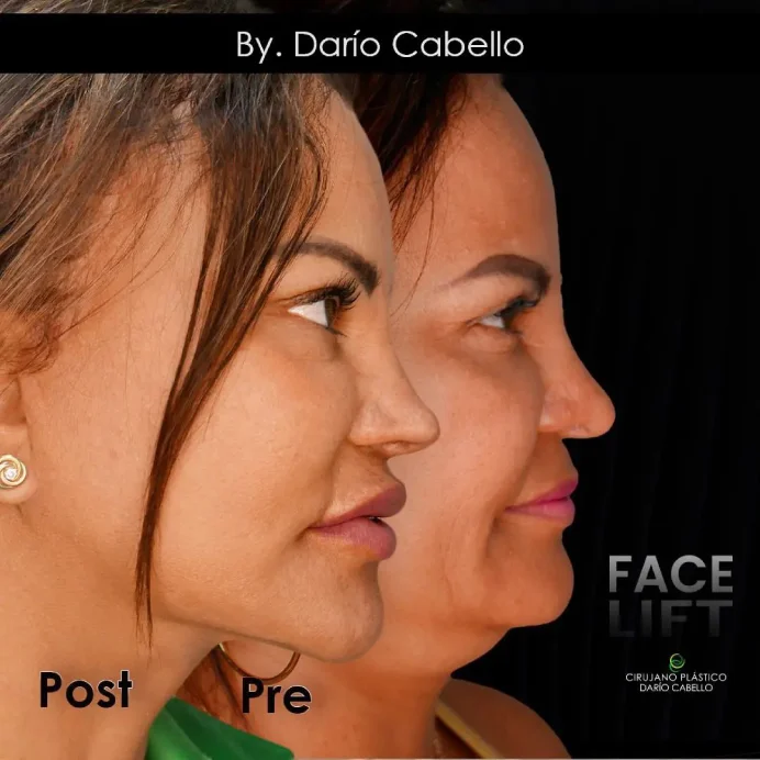 Case 8 Before and After