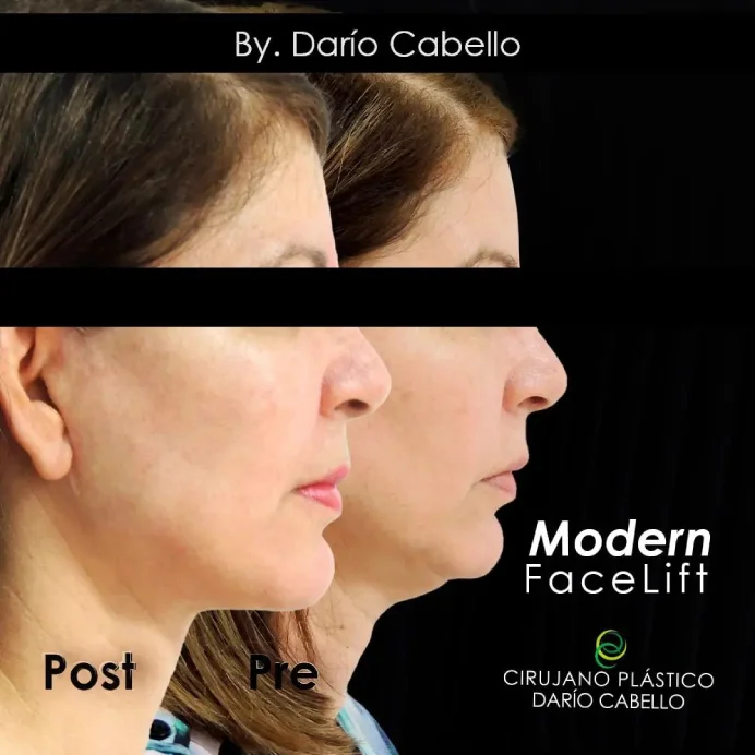 Case 12 Before and After