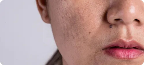Facial Stains