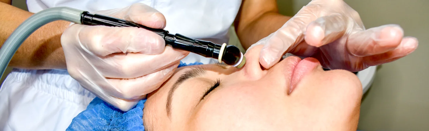 imagen principal de Microdermabrasion
