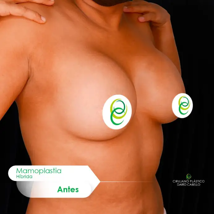 Case 0 Before and After